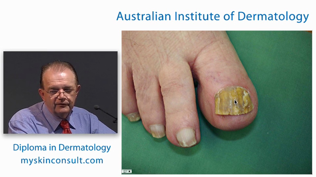 Acne, Rosacea and Common Infectious Diseases Diagnosis and Treatment