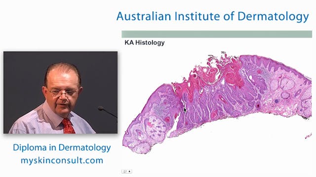 Common Presentations of Skin Cancer D...
