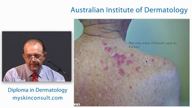 Blistering Skin Diseases and Immunofl...