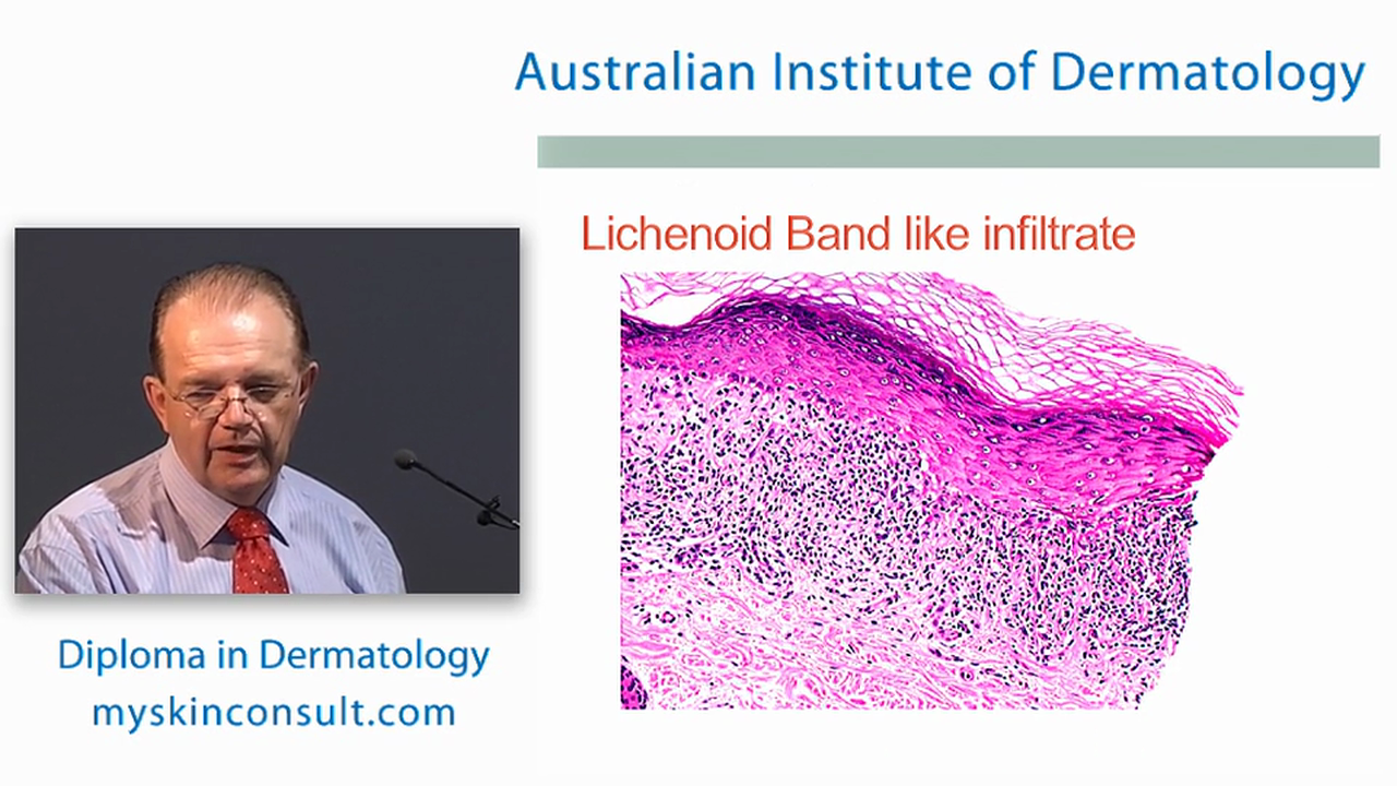 Skin Histopathology Dr. Ian McColl John Flynn Private Hospital