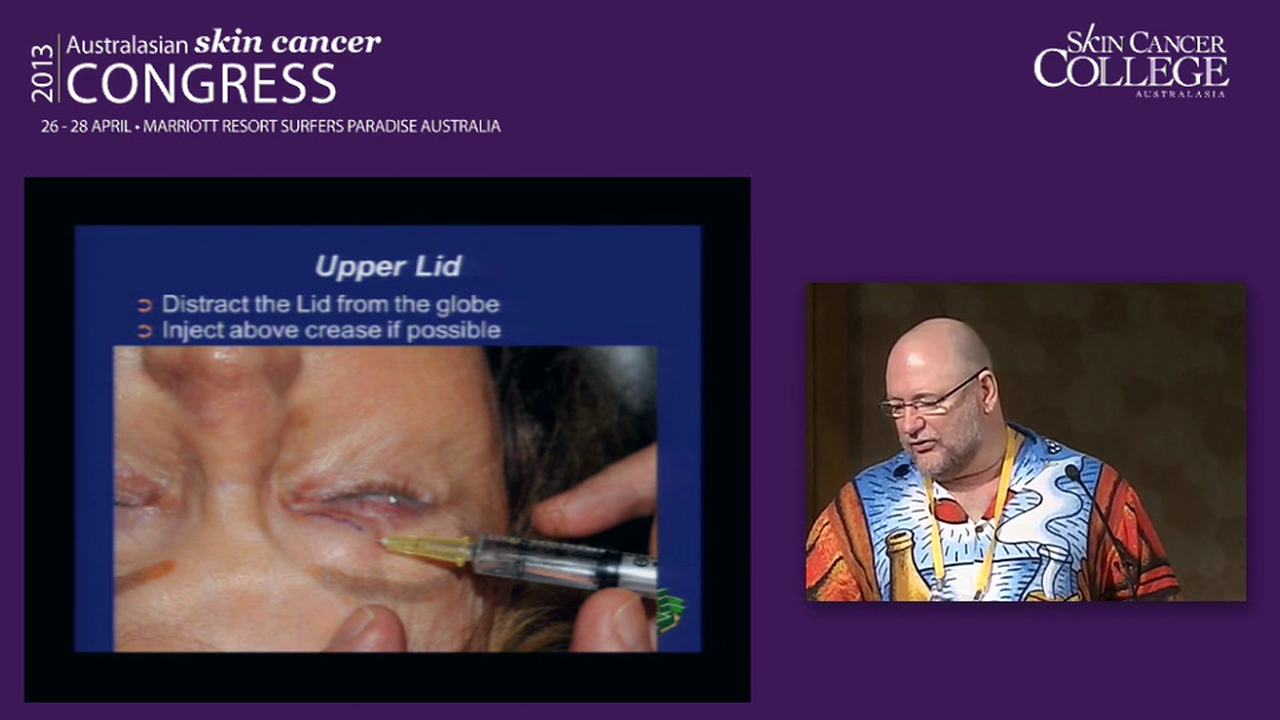 Eye lid dos and don'ts Scott Teske