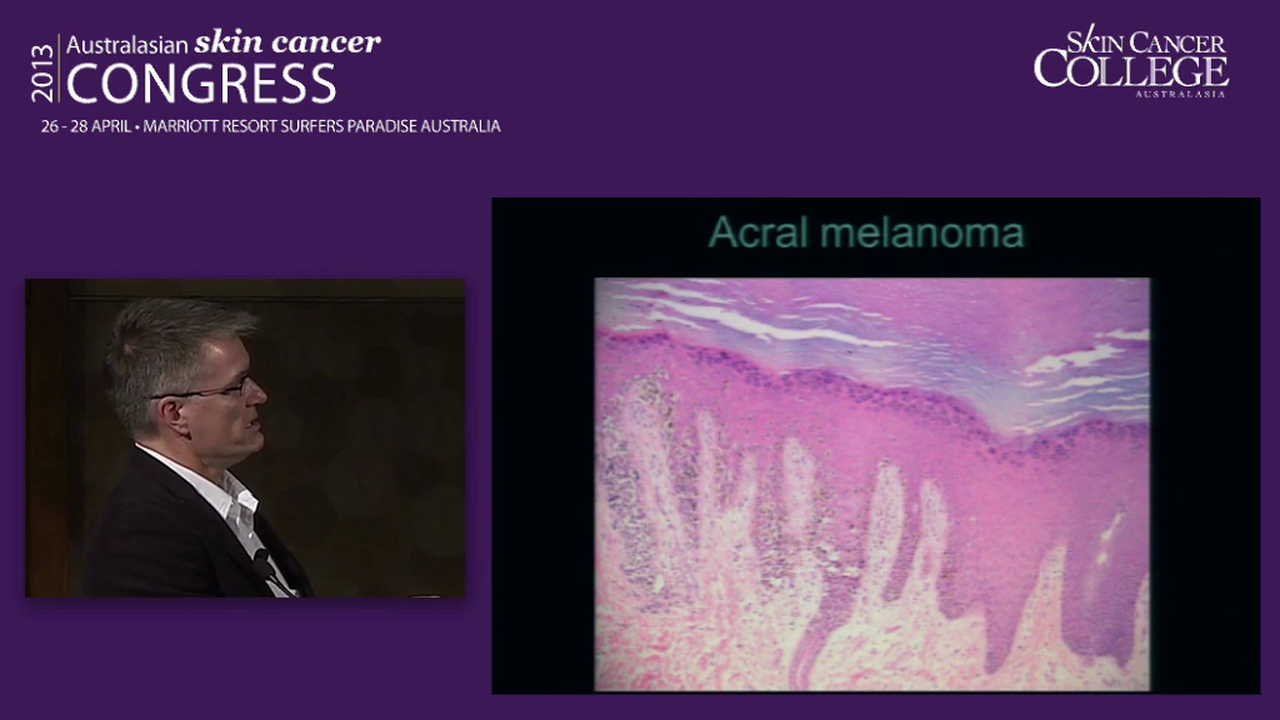 What Dermatopathologists should know about Dermatoscopy Dr Richard Williamson