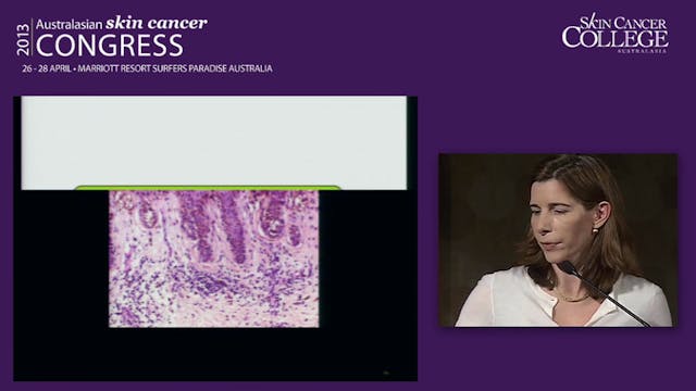 What Dermatoscopists should know abou...