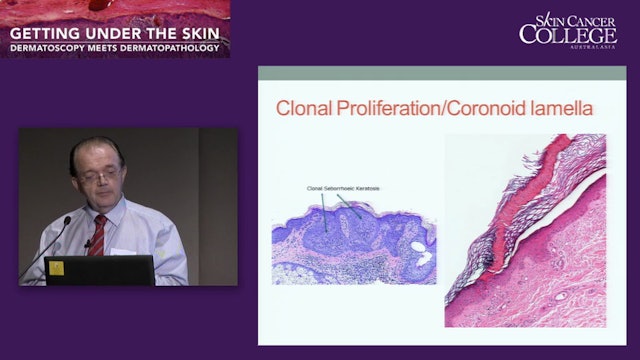 Pathology and Dermatoscopy reports - what does the terminology mean Dr Ian McColl