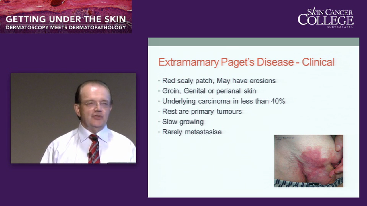 Other tumours important in skin cancer practice Dr Robert Pennisi Dr Ian McColl