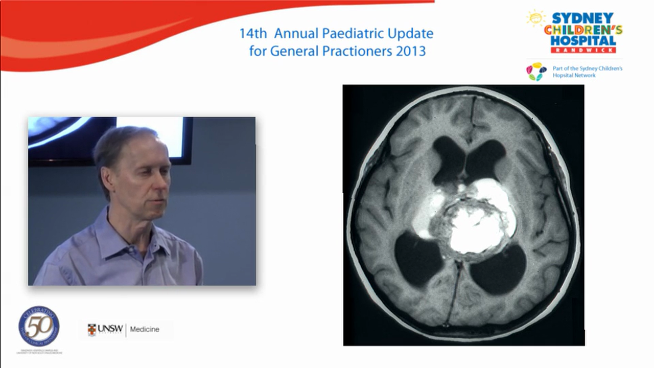 Headaches in children - differential diagnosis and red flags Ian Andrews