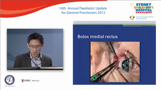 Looking out for lazy eye and squint H...