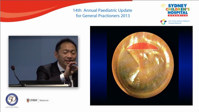 The unsafe ear - when to refer Philip...