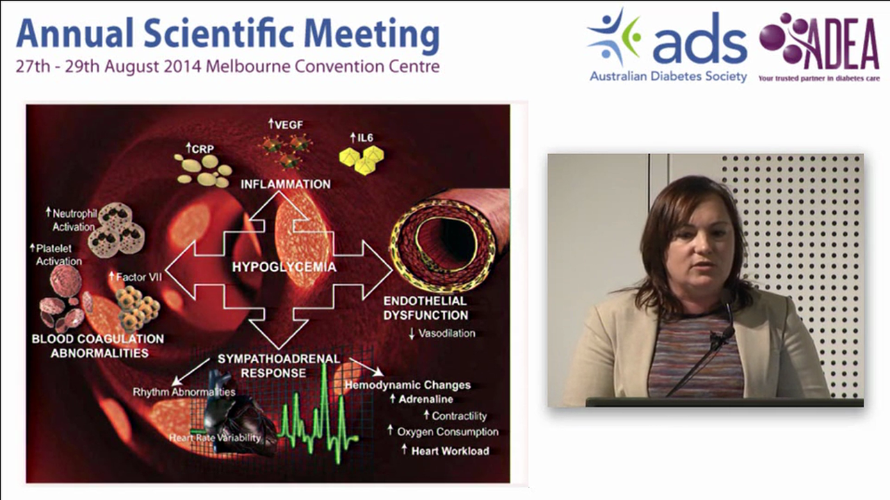 Hypoglycaemia Have we underestimated the problem in patients with Diabetes