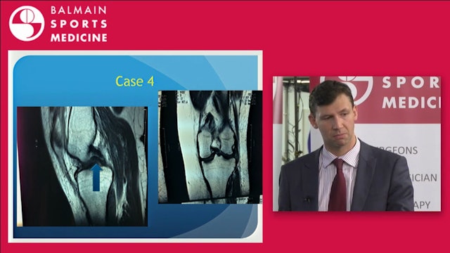 Hip & Knee Cases of relevance to General Practitioners David Broe POW SOS UNSW