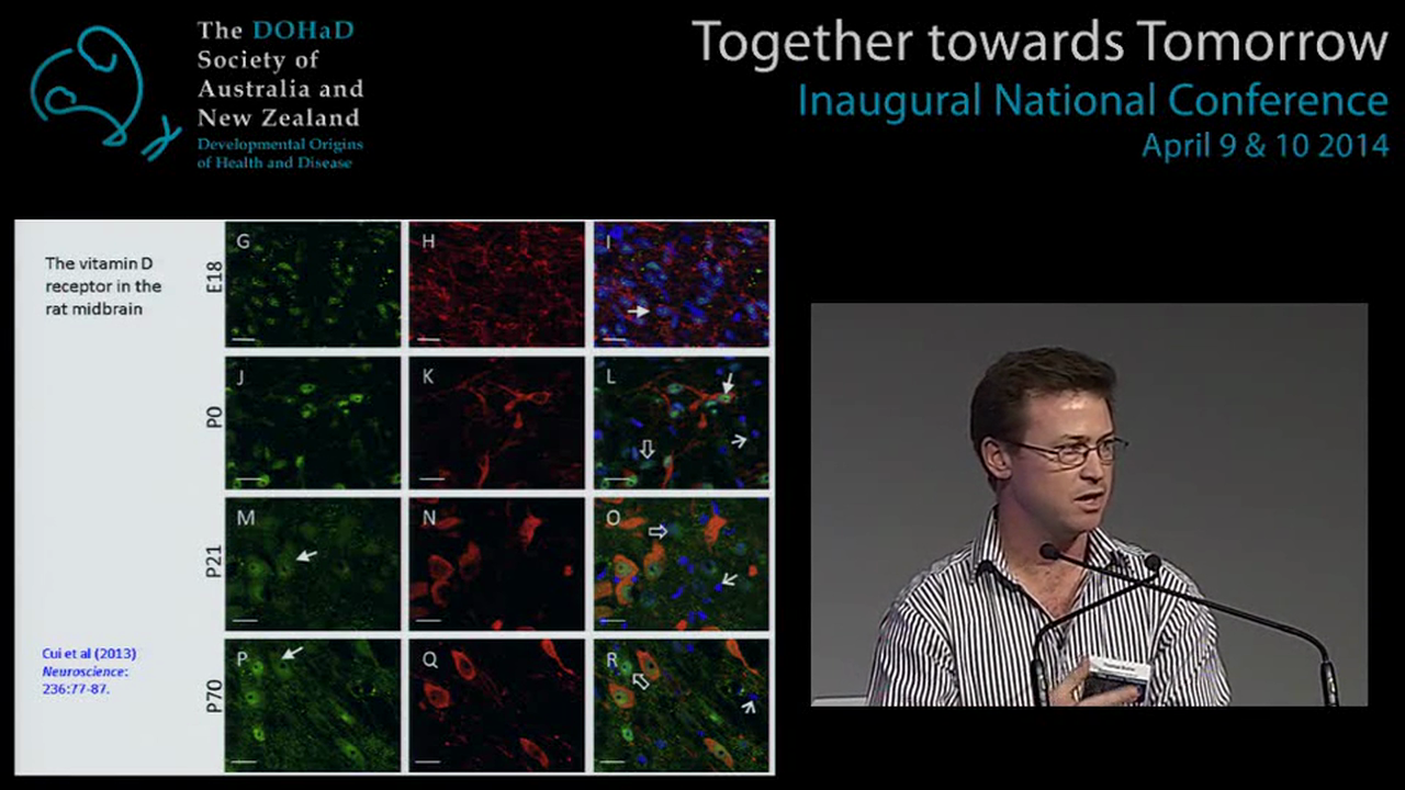 Potential mechanisms of early life origins of mental ill health Tom Burne