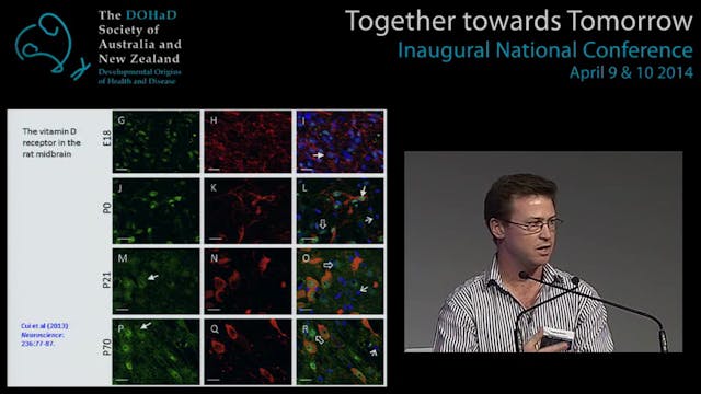 Potential mechanisms of early life or...