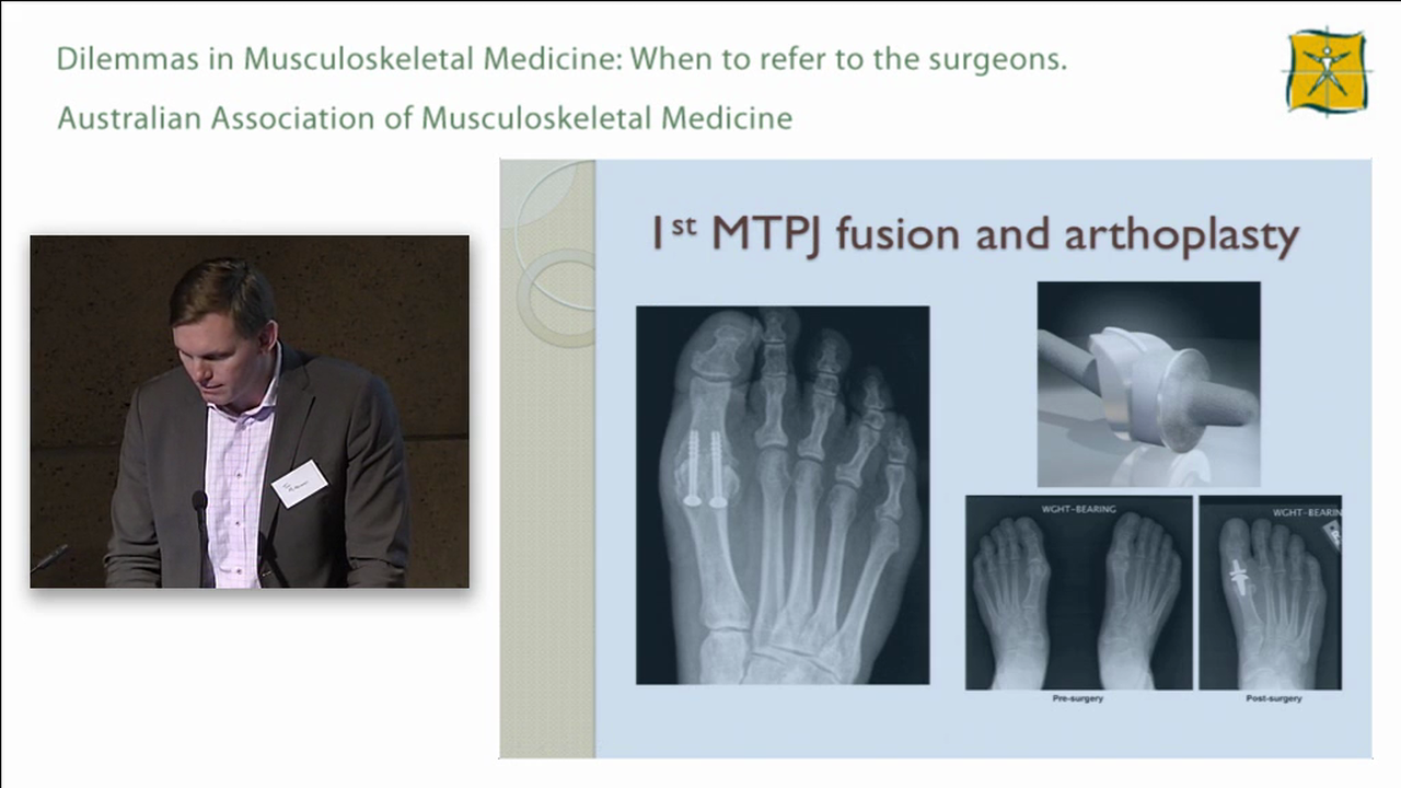 Lower Limb Case 4 David Roselt