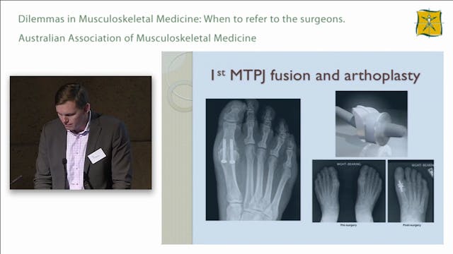Lower Limb Case 4 David Roselt