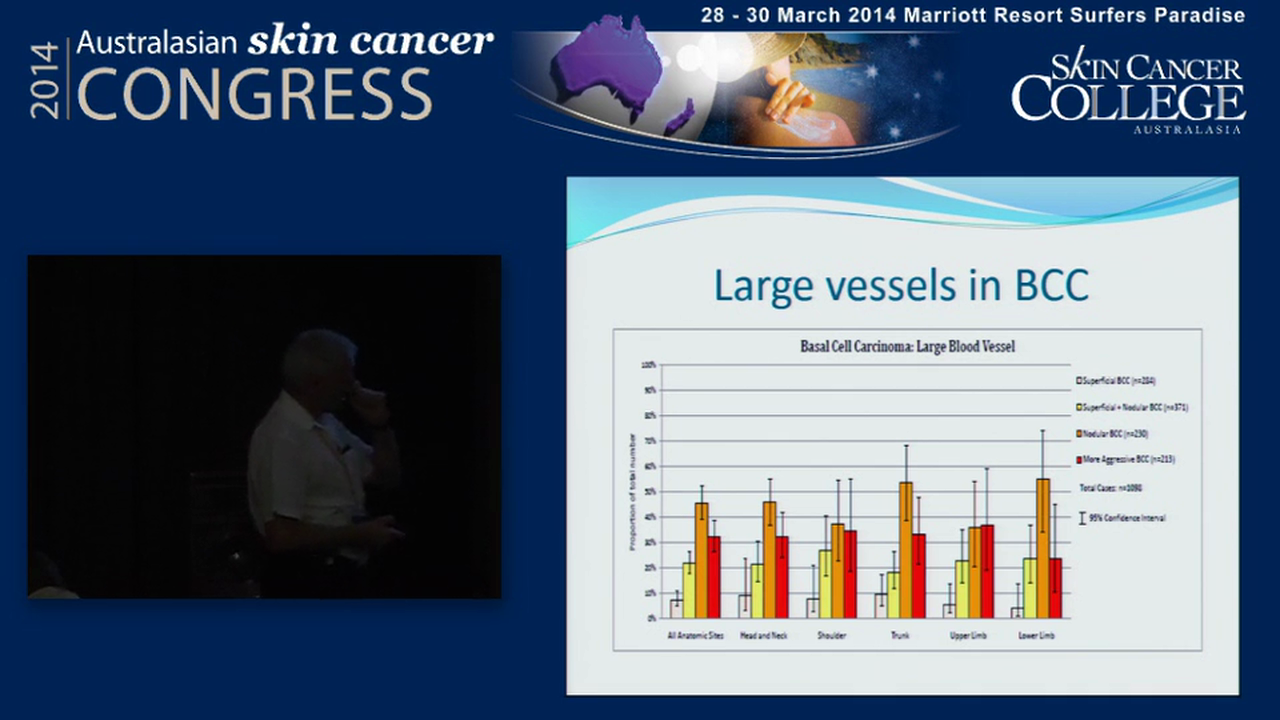 Use of Dermoscopy in management of BCC Dr John Pyne