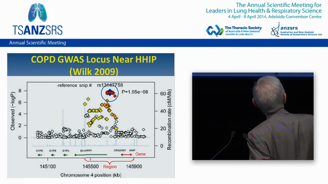Inherited and occupational COPD James Hogg