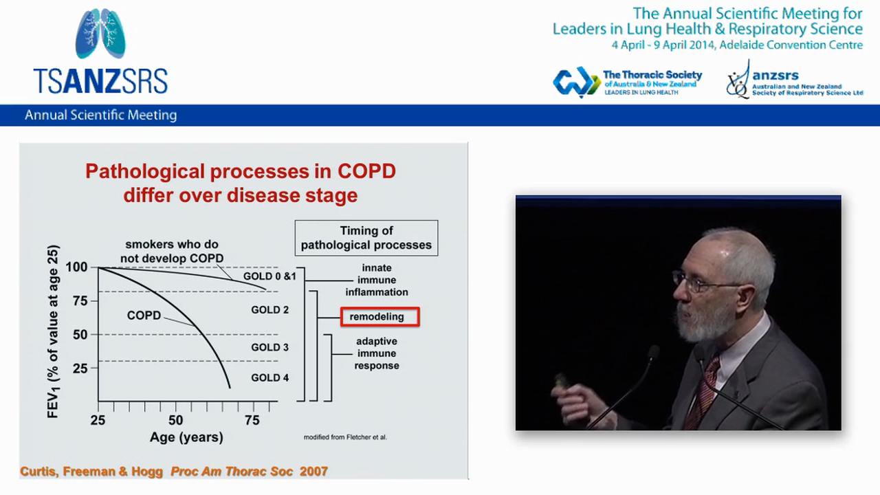 The role of immunobiology in COPD Jeff Curtis