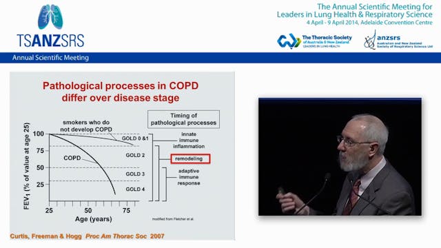 The role of immunobiology in COPD Jef...