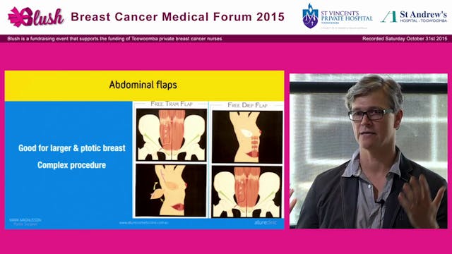 Reconstruction - Mark Magnussen, Allu...