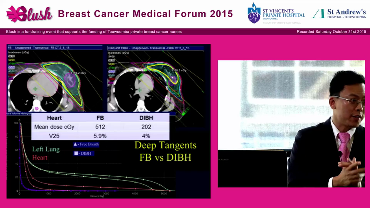 Role of radiotherapy for primary and recurrent disease - Eric Khoo