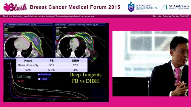 Role of radiotherapy for primary and recurrent disease - Eric Khoo