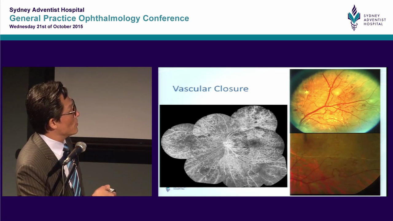 Fundamentals of Diabetic Retinopathy Dr Kwon Kang