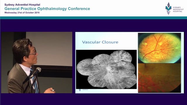 Fundamentals of Diabetic Retinopathy ...