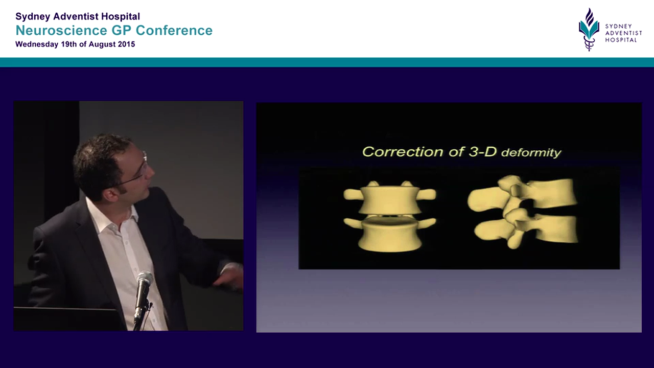 Back pain and spinal deformity Mr Yanni Sergides