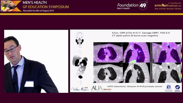 Patterns of Care for Prostate Cancer ...