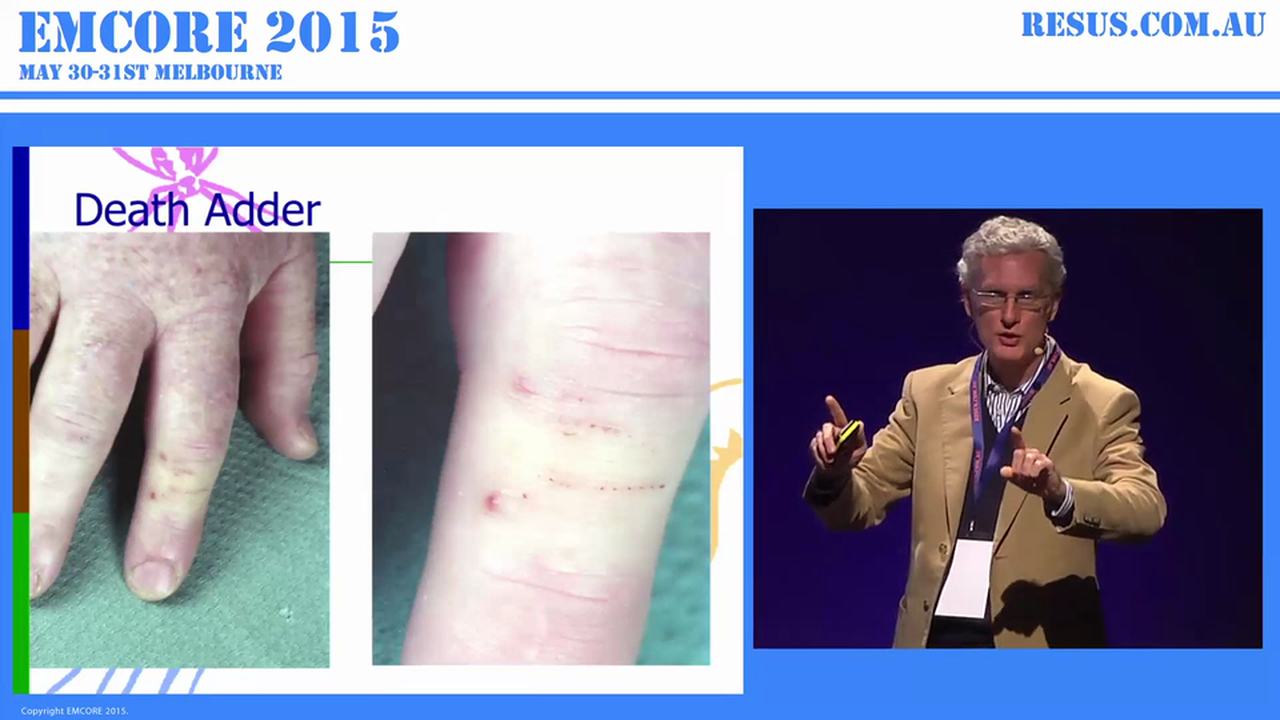 Cold Blooded Bites An Integrated Approach to Snakebite Management Dr Ken Winkle Director of the Australian Venom Research Unit & Senior Research Fellow University of Melbourne