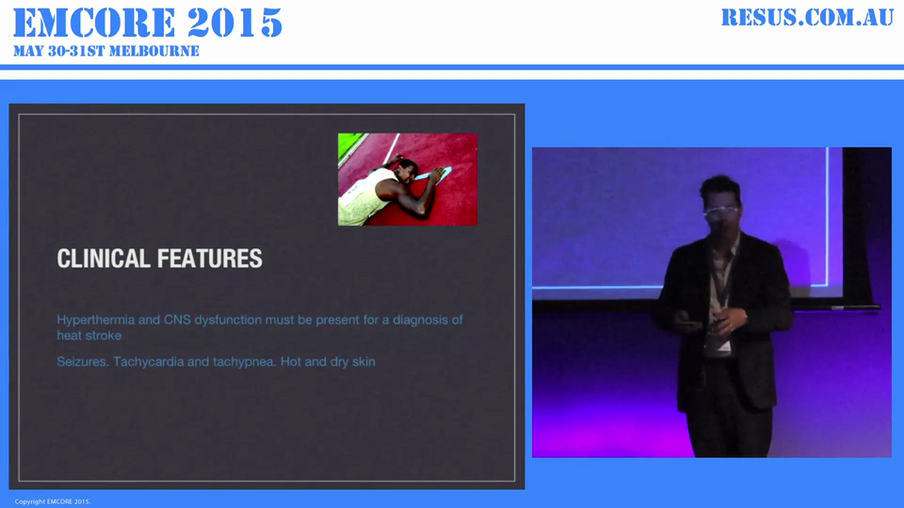 He's Hot and Confused Hyperthermia Dr James Edwards. Emergency Physician Royal Prince Alfred Hospital. Director of Prevocational Education and Training.