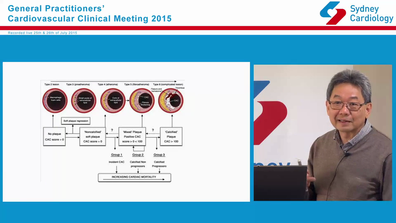 Cardiovascular Risk factor assessment and management Case Dr James Wong, MBBS, (Hons), FRACP, FCSANZ General Adult Cardiologist