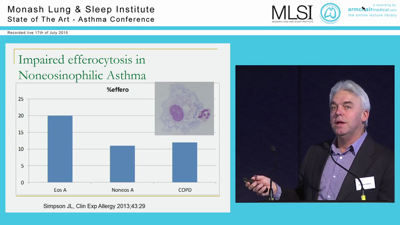 Asthma phenotypes and biomarkers Prof Peter Gibson