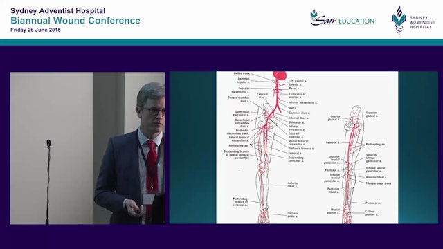 Arteries, veins & compression get squished Dr D Robinson