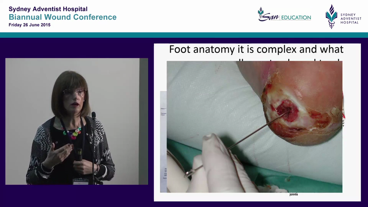 Give an inch and they’ll take a foot diabetes & wound healing Jan Rice