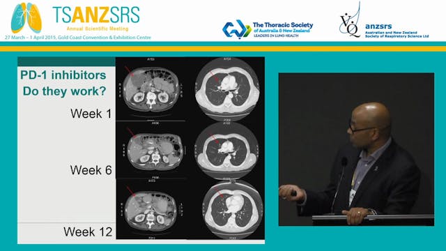 Latest advances in the treatment of m...