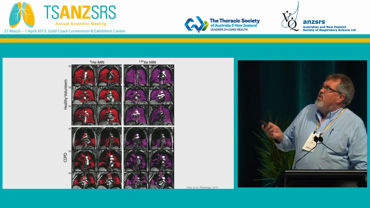 Pitfalls in functional imaging Kim Prisk University of San Diego, USA