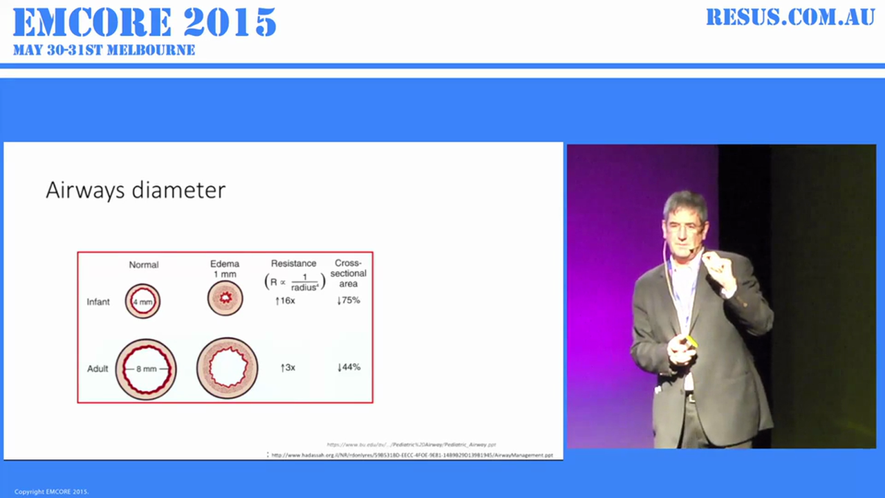 Paediatric resuscitation Theory AProf Shane Curran  Emergency Physician and Director of Wagga Wagga ED.
