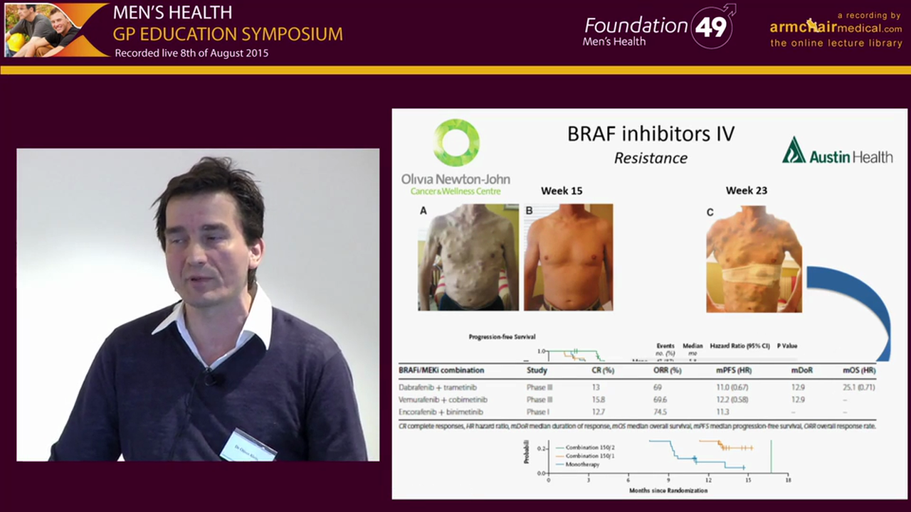 Treatment of Metastatic Melanoma -  Moving Towards Targeted Therapy and Modern Immunotherapy Dr Oliver Klein Oncologist