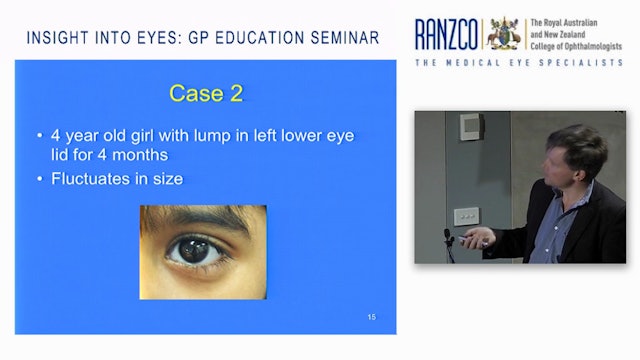 Paediatric Eye Problems  Prof James Elder