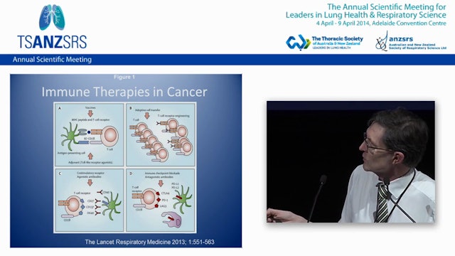 Cancer vaccines and immunotherapy for lung cancer Jeffrey Bowden