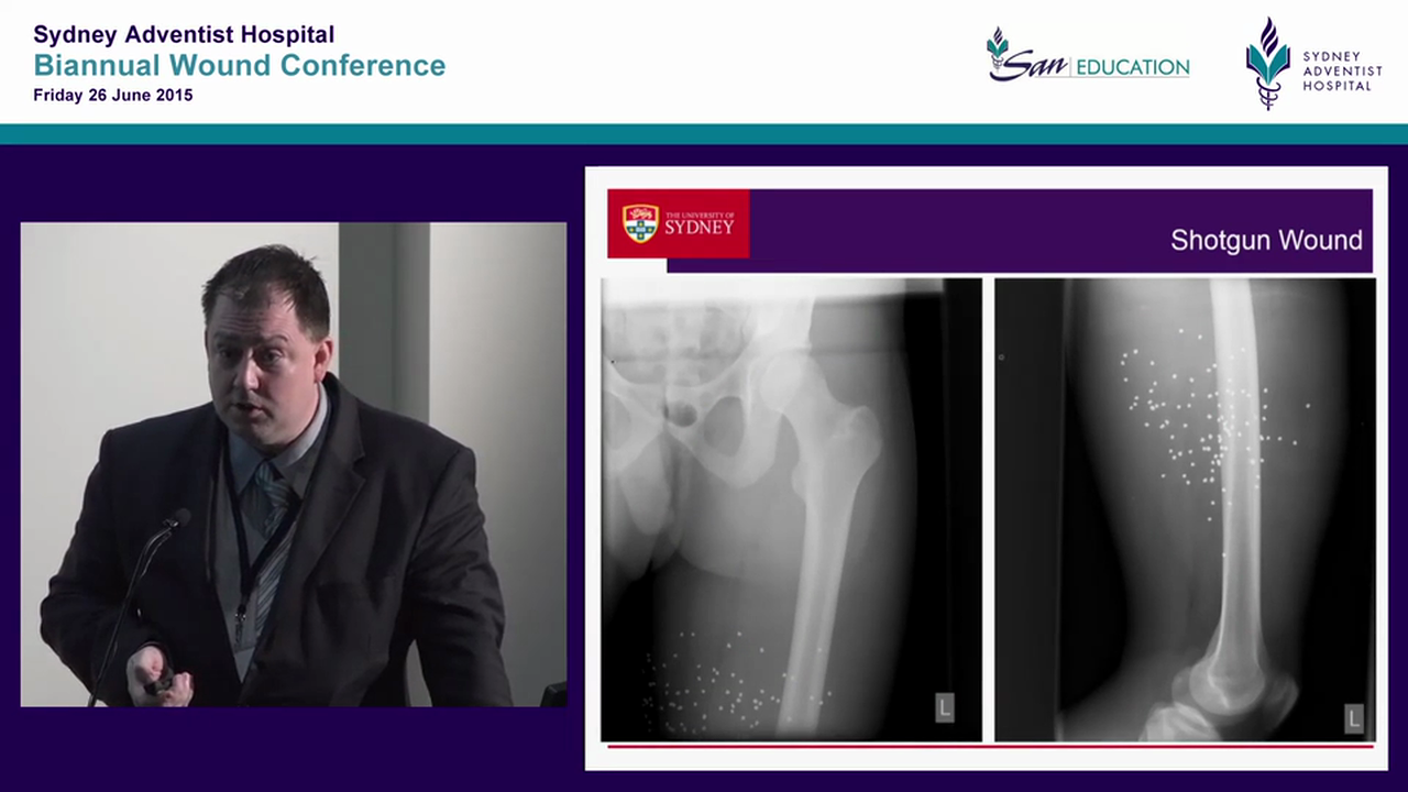 Fights, bites & accidents  traumatic wounds Matt Dutton