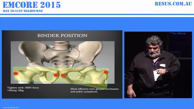 Unstable Pelvic Fracture AProf Peter ...