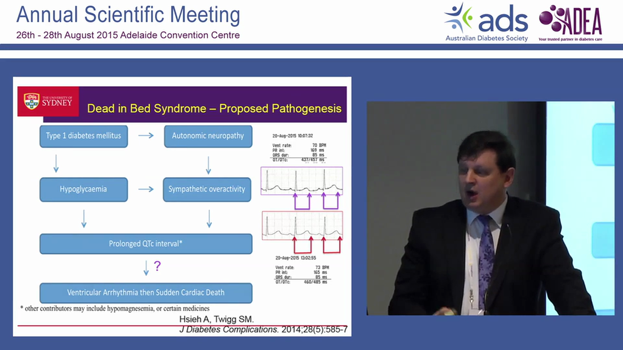 The enigma of the Dead in bed syndrome Stephen Twigg
