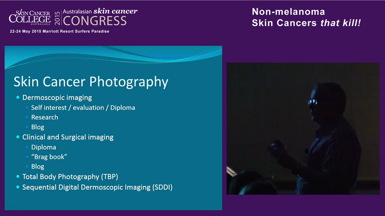 Dermoscopy of Non Melanoma Skin Cancer Dr Richard Johns