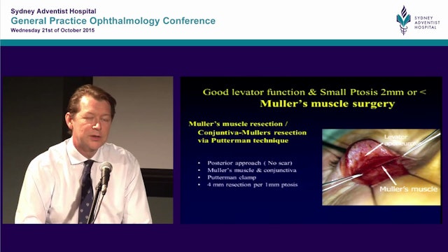 Eyelid ptosis surgery indications and management Dr Simon Taylor