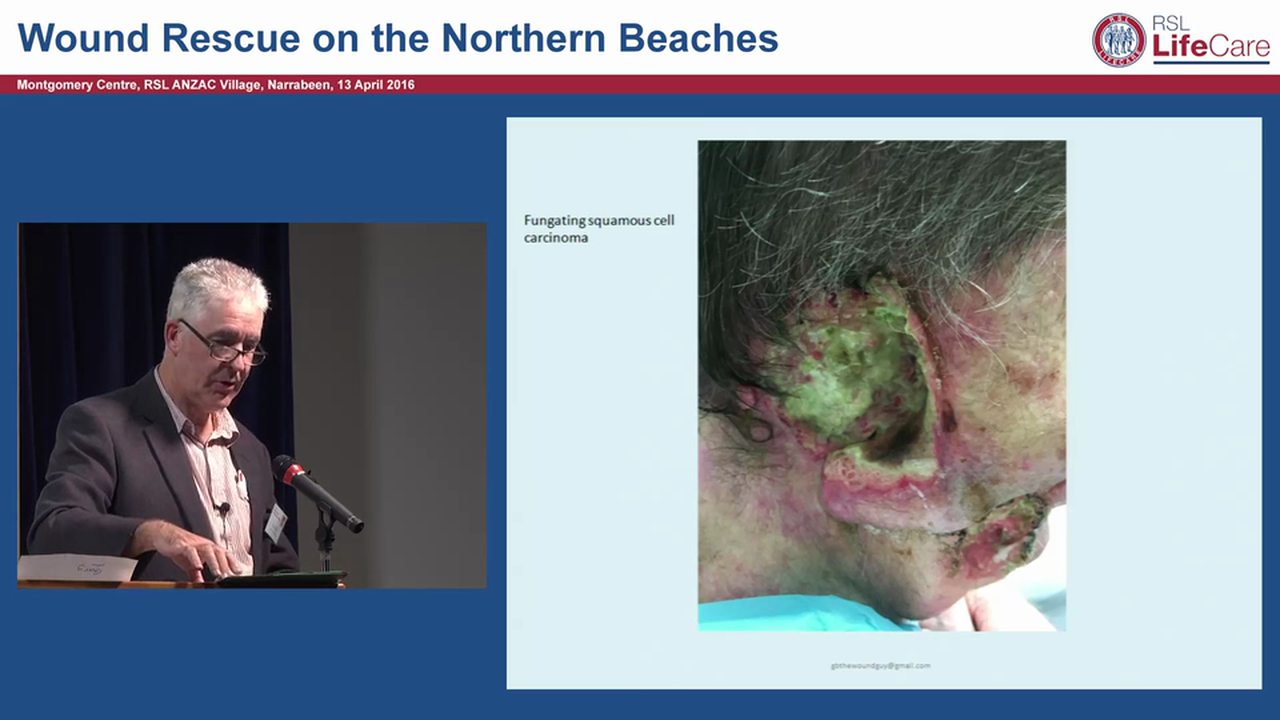 Malodourous Wounds Gary Bain