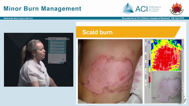 Understanding referral process & fact...