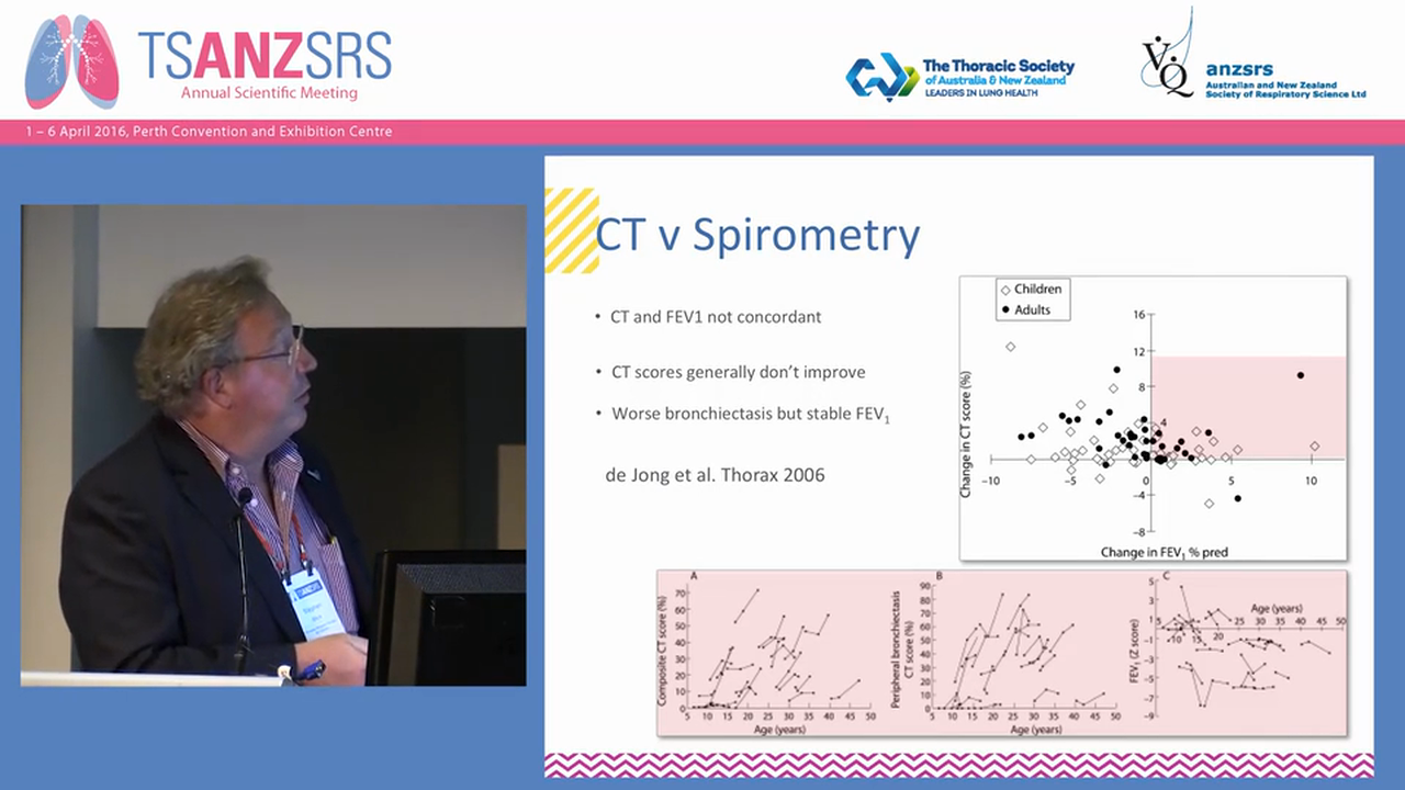 The impact of cystic fibrosis Stephen Stick, Princess Margaret Hospital for Children, WA