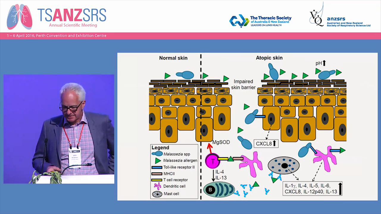 Asthma, allergy and ALSPAC John Henderson, University of Bristol, UK